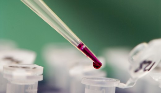 dieta, esame sangue analisi