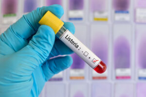 Campione di sangue in una provetta positivo per la listeriosi; concept: listeria monocytogenes