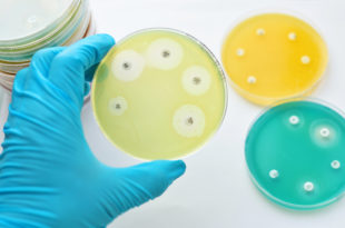 resistenza antibiotici piastre laboratorio batteri AdobeStock_105452319