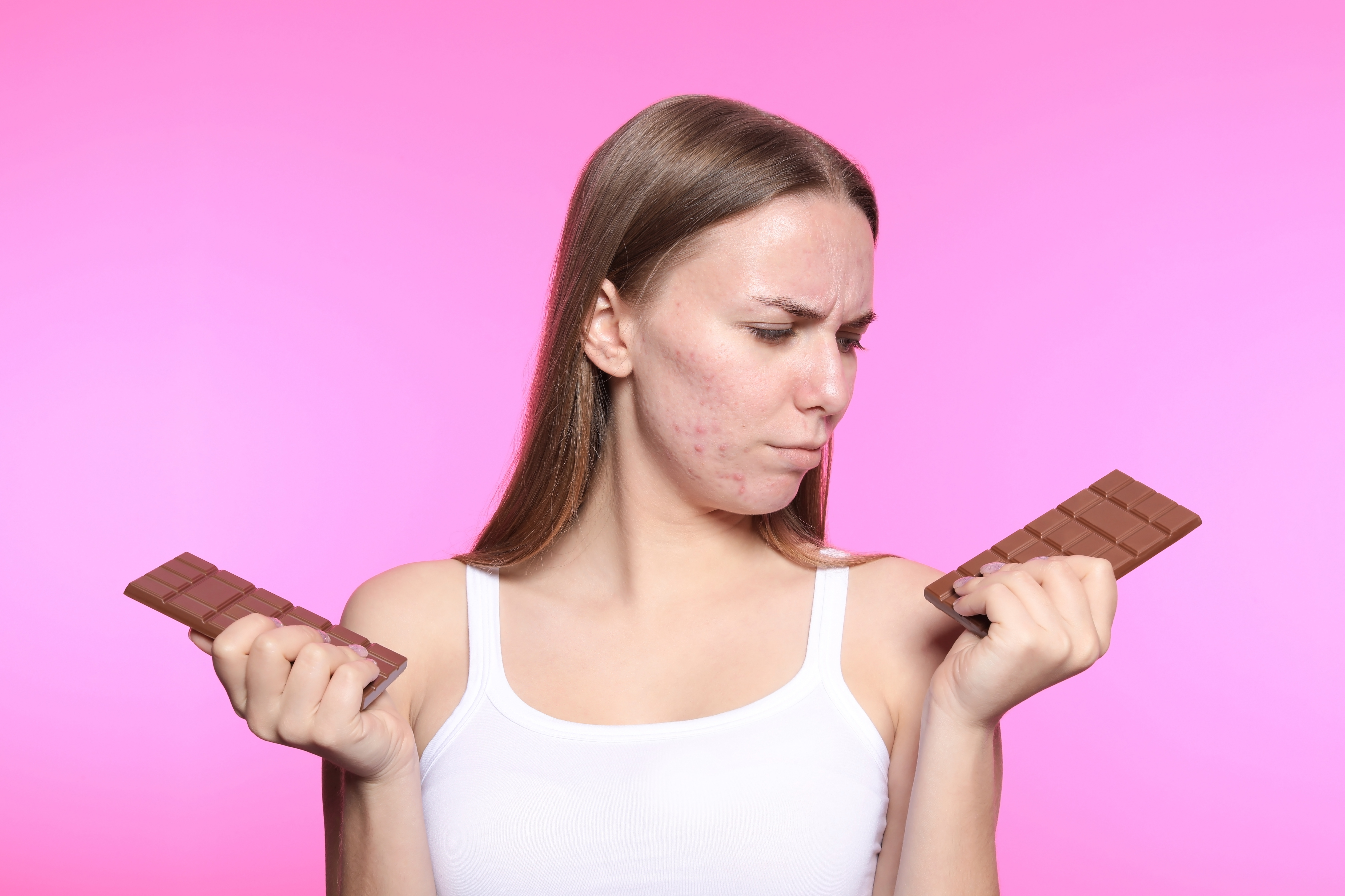 Young woman with acne problem holding chocolate bars on color background. Skin allergy