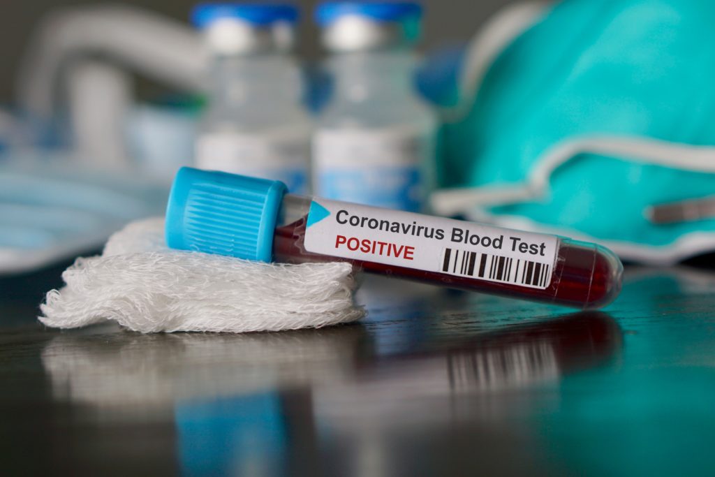 coronavirus provetta sangue diagnosi infezione