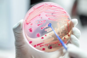 Piastra petri con colonie di batteri; concept: microrganismi, microbi