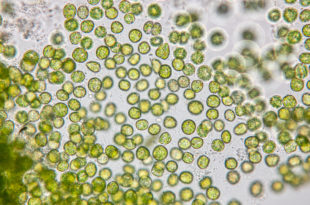 Education of chlorella under the microscope in Lab. microalghe chlorella