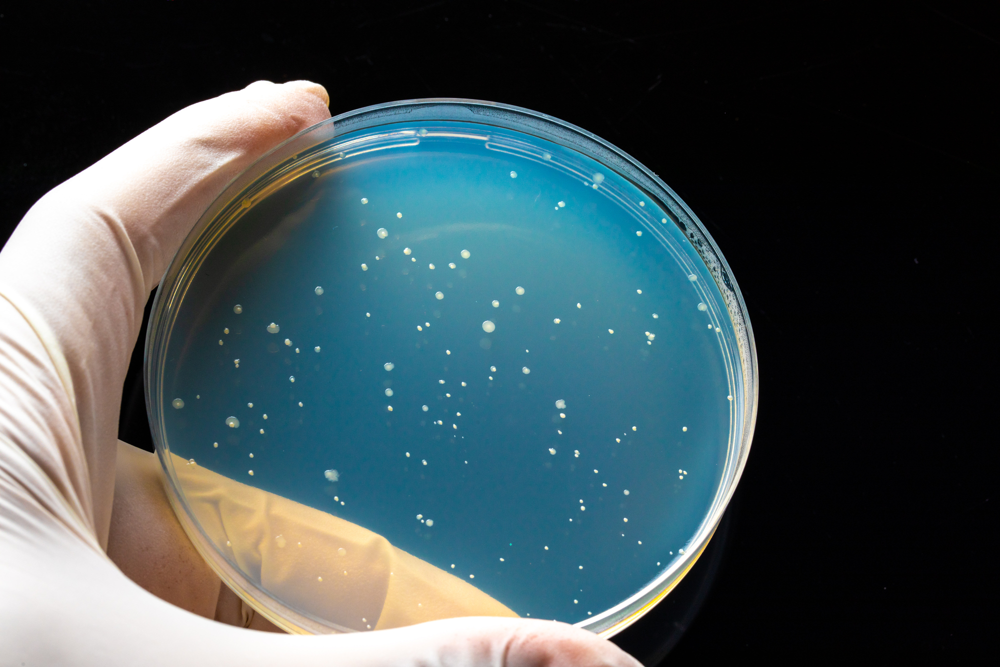 Piastra petri con colonie di batteri; concept: microbiologica, rischio microbiologico, Salmonella, Listeria, Escherichia coli