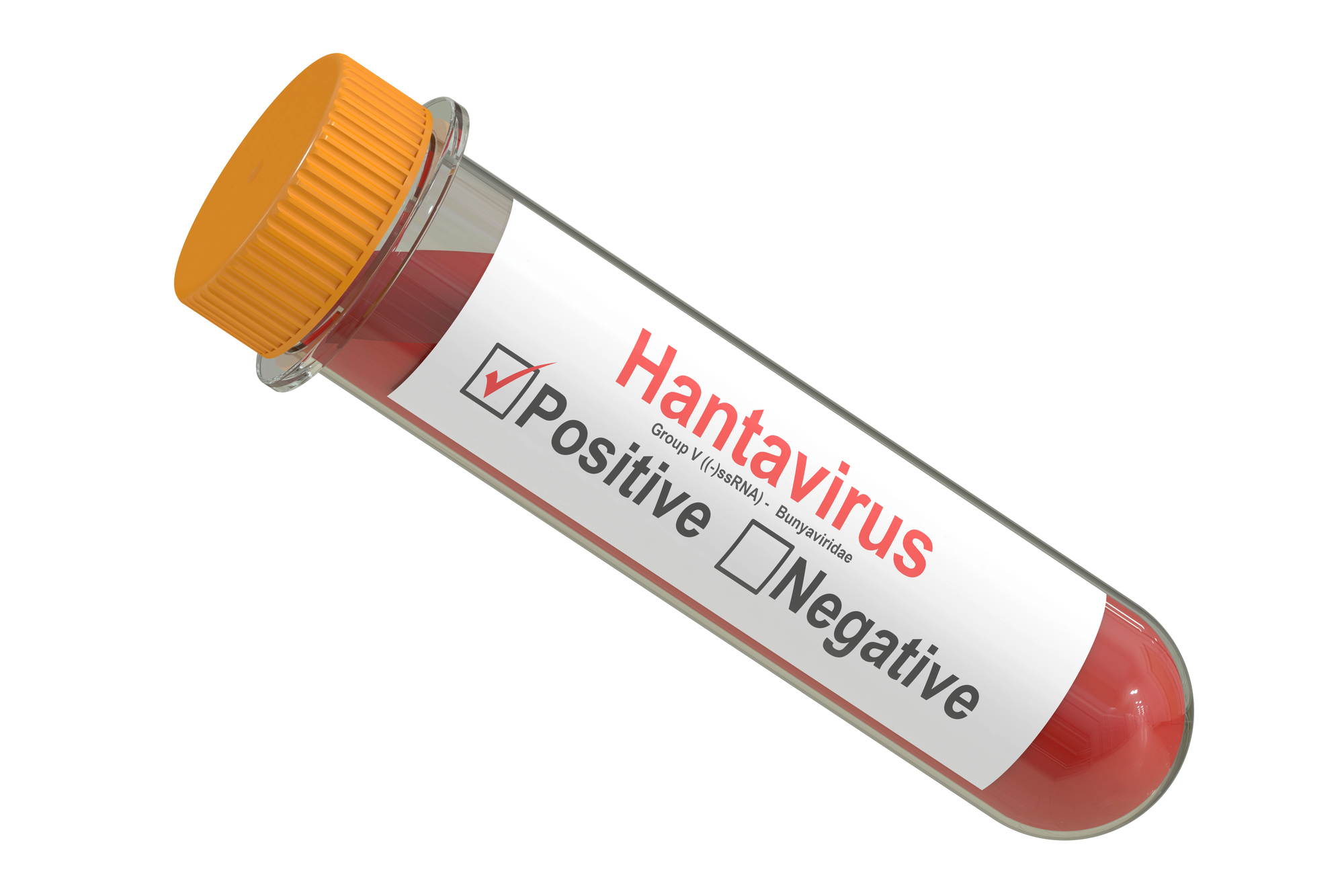 Hantavirus